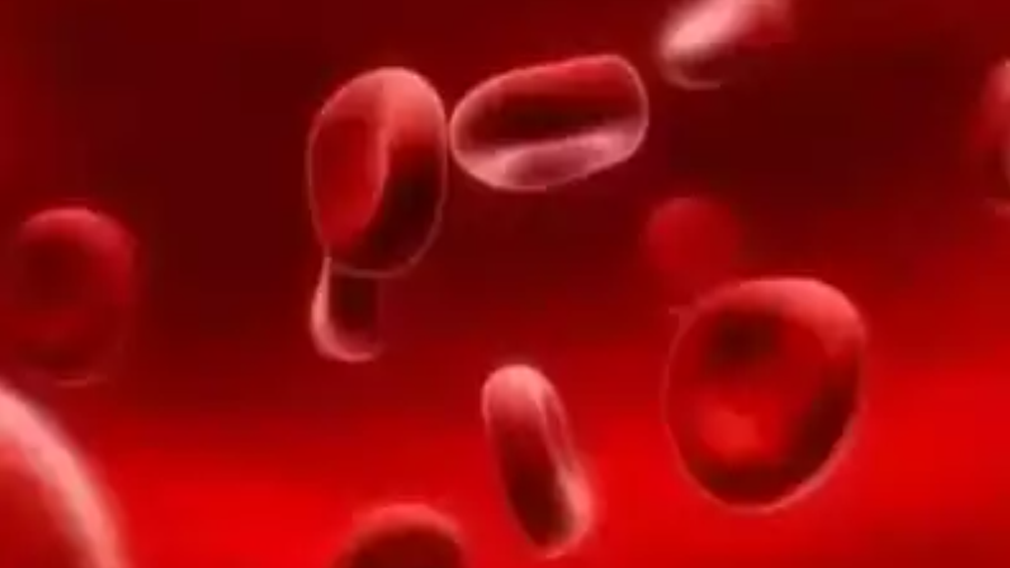 A group of red blood cells in a background indicative of Glanzmann's Thrombasthenia.